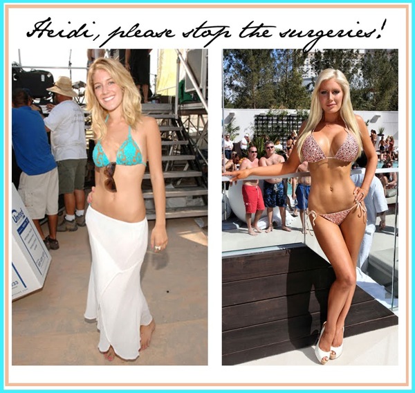 heidi montag plastic surgery 