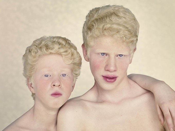 Gustavo Lacerda - Albinos 04.jpeg