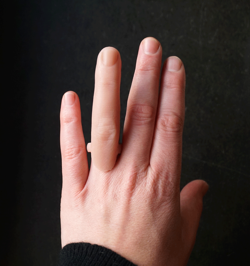 На 1 руке 6 пальцев. Безымянный палец.